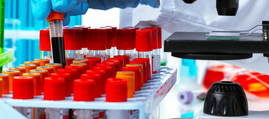 Blood testing image